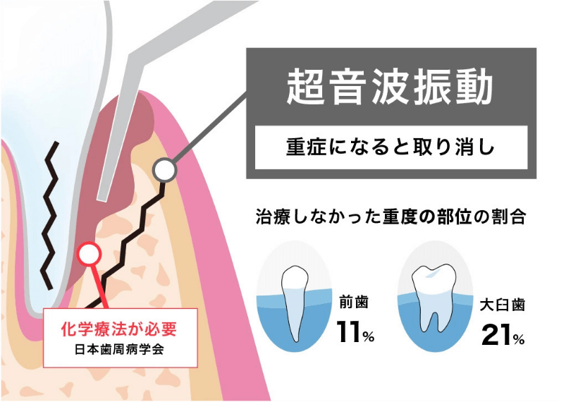 従来の治療方法