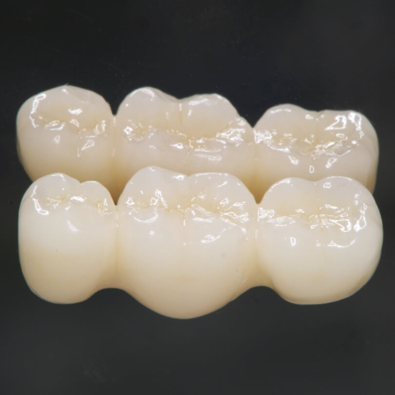 ジルコニアクラウン