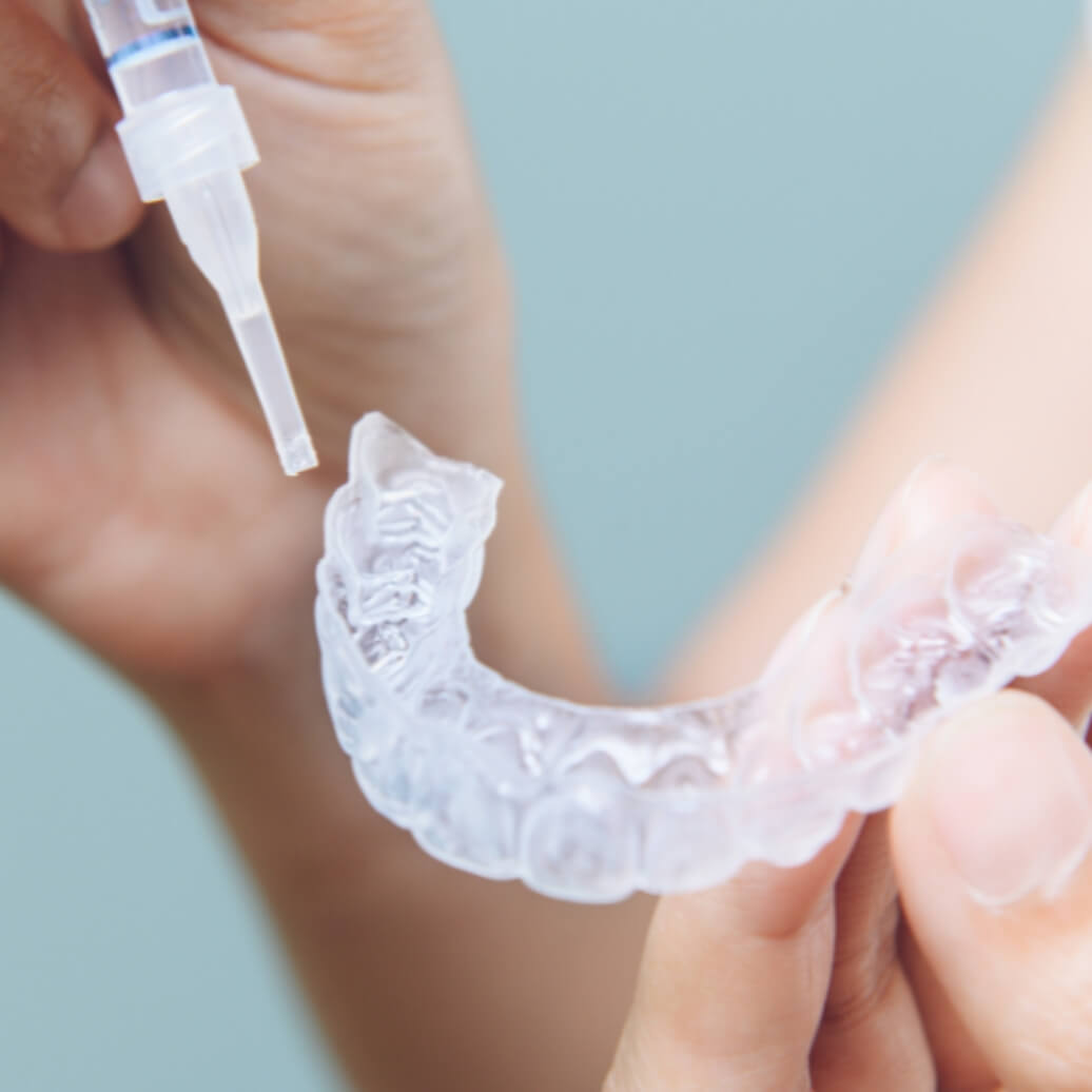 ホームホワイトニング