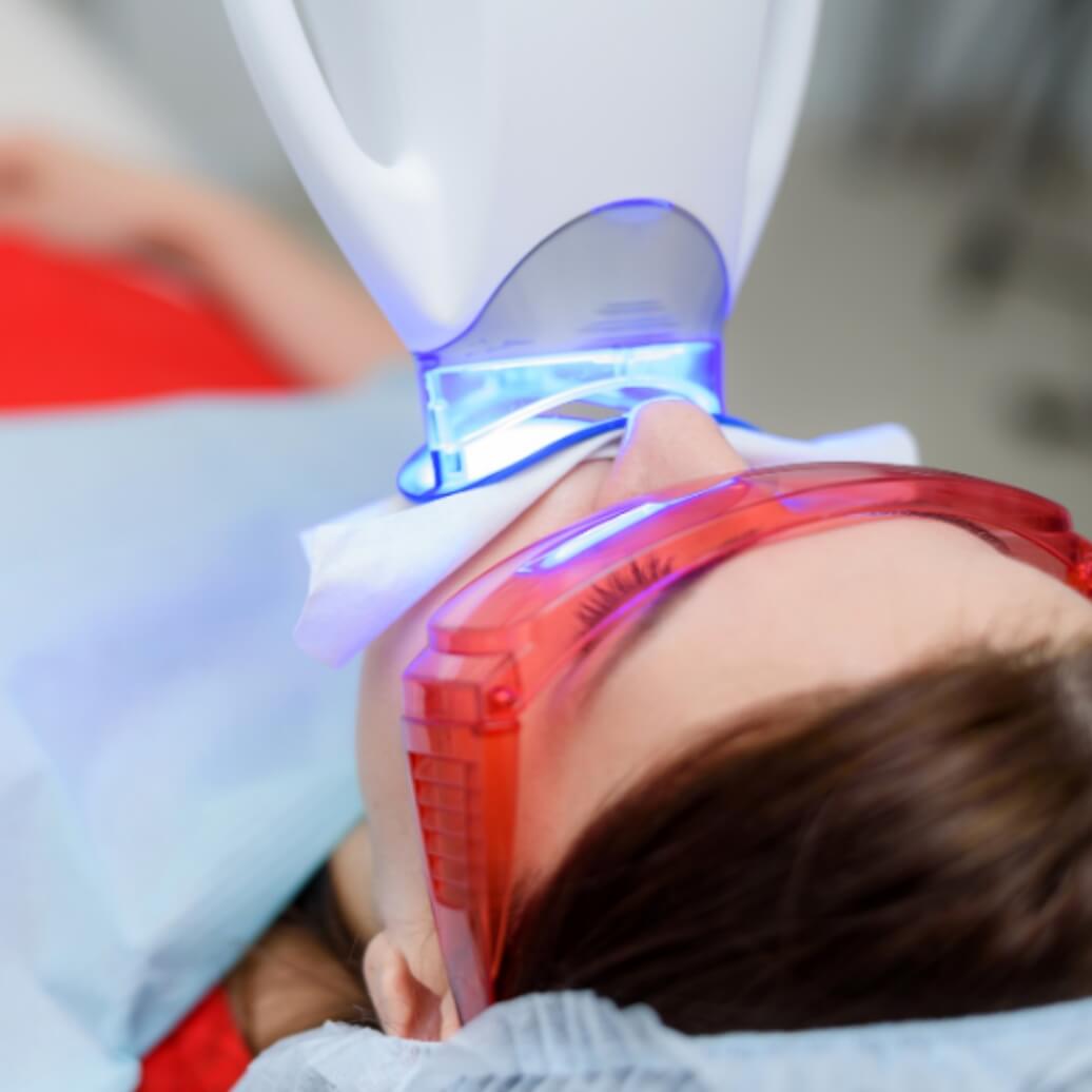 オフィスホワイトニング