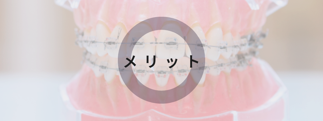 メリット