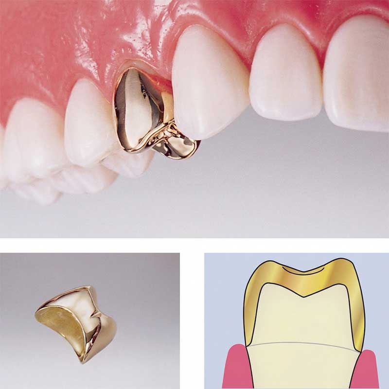 ゴールドクラウン